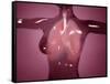 Conceptual Image of Female Body with Lungs, Glassy Look-null-Framed Stretched Canvas