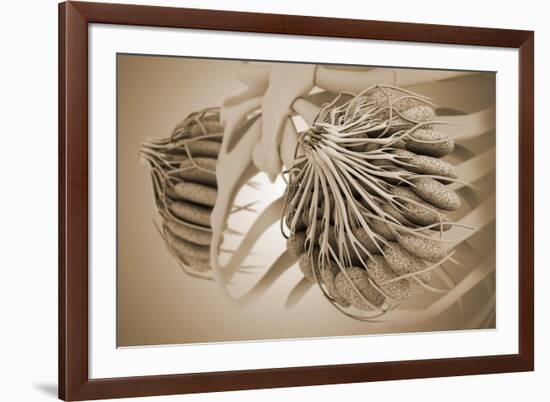 Conceptual Image of Female Breast Anatomy-null-Framed Art Print