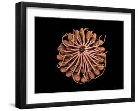 Conceptual Image of Female Breast Anatomy-null-Framed Art Print