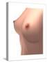 Conceptual Image of Female Breast-null-Stretched Canvas