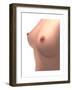 Conceptual Image of Female Breast-null-Framed Art Print