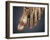 Conceptual Image of Gout in the Big Toe-null-Framed Art Print