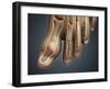 Conceptual Image of Gout in the Big Toe-null-Framed Art Print