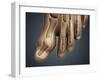 Conceptual Image of Gout in the Big Toe-null-Framed Art Print