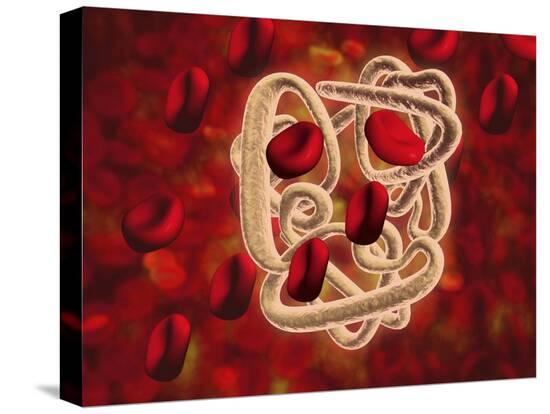 Stretched Canvas Print, , large
