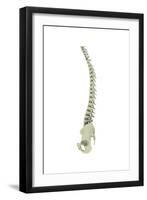 Conceptual Image of Human Backbone-null-Framed Art Print