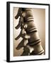 Conceptual Image of Human Backbone-null-Framed Art Print