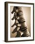 Conceptual Image of Human Backbone-null-Framed Art Print