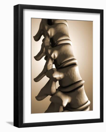 Conceptual Image of Human Backbone-null-Framed Art Print