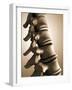 Conceptual Image of Human Backbone-null-Framed Art Print