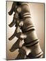 Conceptual Image of Human Backbone-null-Mounted Art Print