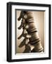 Conceptual Image of Human Backbone-null-Framed Art Print