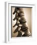 Conceptual Image of Human Backbone-null-Framed Art Print