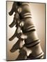 Conceptual Image of Human Backbone-null-Mounted Art Print