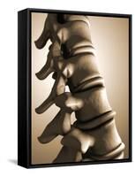 Conceptual Image of Human Backbone-null-Framed Stretched Canvas