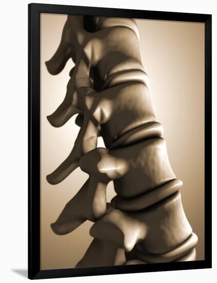 Conceptual Image of Human Backbone-null-Framed Art Print