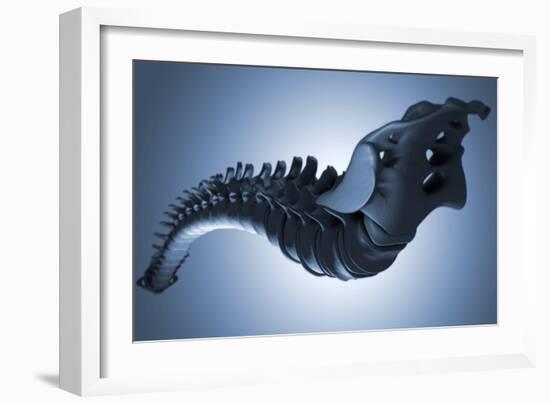 Conceptual Image of Human Backbone-null-Framed Art Print