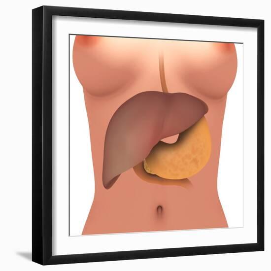 Conceptual Image of Human Digestive System in Female Body-null-Framed Art Print