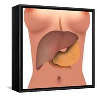 Conceptual Image of Human Digestive System in Female Body-null-Framed Stretched Canvas