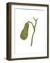 Conceptual Image of Human Gall Bladder-null-Framed Art Print