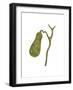 Conceptual Image of Human Gall Bladder-null-Framed Art Print