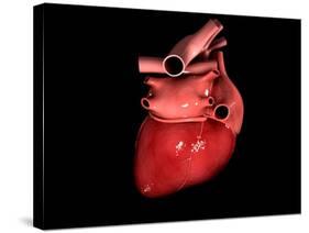 Conceptual Image of Human Heart-null-Stretched Canvas