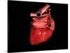 Conceptual Image of Human Heart-null-Stretched Canvas