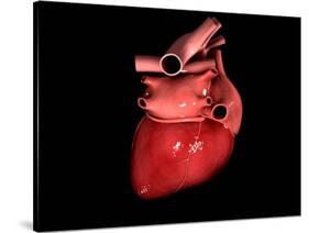 Conceptual Image of Human Heart-null-Stretched Canvas
