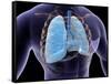 Conceptual Image of Human Lungs and Rib Cage-null-Framed Stretched Canvas