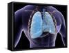 Conceptual Image of Human Lungs and Rib Cage-null-Framed Stretched Canvas