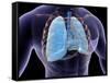 Conceptual Image of Human Lungs and Rib Cage-null-Framed Stretched Canvas