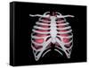 Conceptual Image of Human Lungs and Rib Cage-null-Framed Stretched Canvas