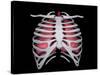 Conceptual Image of Human Lungs and Rib Cage-null-Stretched Canvas