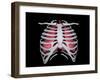 Conceptual Image of Human Lungs and Rib Cage-null-Framed Art Print