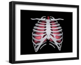 Conceptual Image of Human Lungs and Rib Cage-null-Framed Art Print