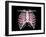 Conceptual Image of Human Lungs and Rib Cage-null-Framed Art Print