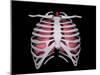 Conceptual Image of Human Lungs and Rib Cage-null-Mounted Art Print