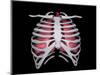 Conceptual Image of Human Lungs and Rib Cage-null-Mounted Art Print