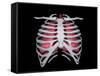 Conceptual Image of Human Lungs and Rib Cage-null-Framed Stretched Canvas