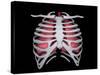 Conceptual Image of Human Lungs and Rib Cage-null-Stretched Canvas