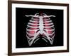 Conceptual Image of Human Lungs and Rib Cage-null-Framed Art Print