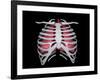 Conceptual Image of Human Lungs and Rib Cage-null-Framed Art Print