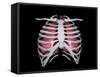 Conceptual Image of Human Lungs and Rib Cage-null-Framed Stretched Canvas