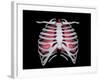 Conceptual Image of Human Lungs and Rib Cage-null-Framed Art Print