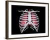 Conceptual Image of Human Lungs and Rib Cage-null-Framed Art Print