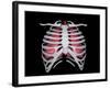 Conceptual Image of Human Lungs and Rib Cage-null-Framed Art Print