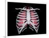 Conceptual Image of Human Lungs and Rib Cage-null-Framed Art Print