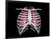 Conceptual Image of Human Lungs and Rib Cage-null-Framed Art Print