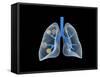 Conceptual Image of Human Lungs-null-Framed Stretched Canvas