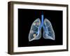 Conceptual Image of Human Lungs-null-Framed Art Print